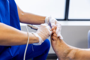 Close-up of Mirka Grell-Willins performing detailed foot care on a patient's toes while wearing gloves and using specialized equipment.